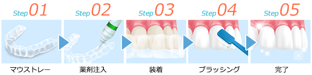 ホームホワイトニングの流れ
